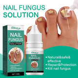 Nail Fungus Remover