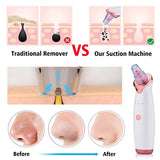 Vacuum Blackhead Remover Face Black Spots Cleaner White Dot Pimple Removal